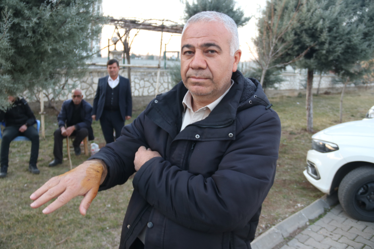 Diyarbakır'da başıboş köpek 3 kişiye saldırdı