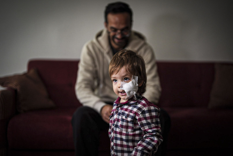 Pitbull saldırısına uğrayan iki kardeşten Efe de taburcu edildi