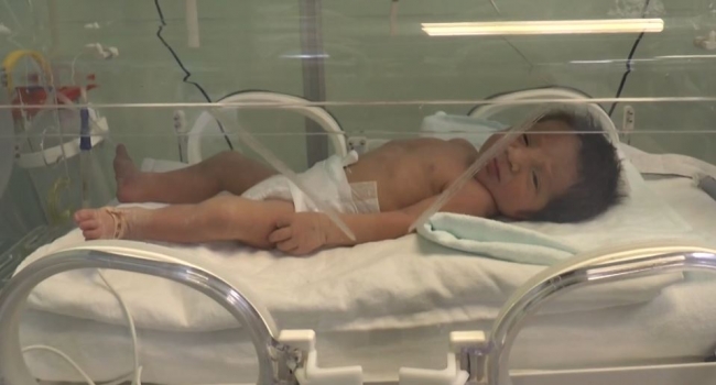 Adıyaman'da toprağa gömülen bebeğin sağlık durumu iyi