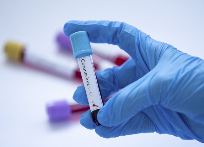 Koronavirüsü ağır geçirenlerin genetik şifresi çözüldü