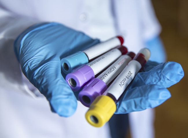 Koronavirüsü ağır geçirenlerin genetik şifresi çözüldü