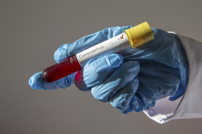Koronavirüsü ağır geçirenlerin genetik şifresi çözüldü