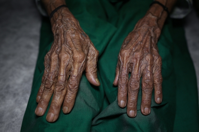 120 yaşındaki Arakanlı kadın Türkiye'nin desteğiyle hayata tutundu