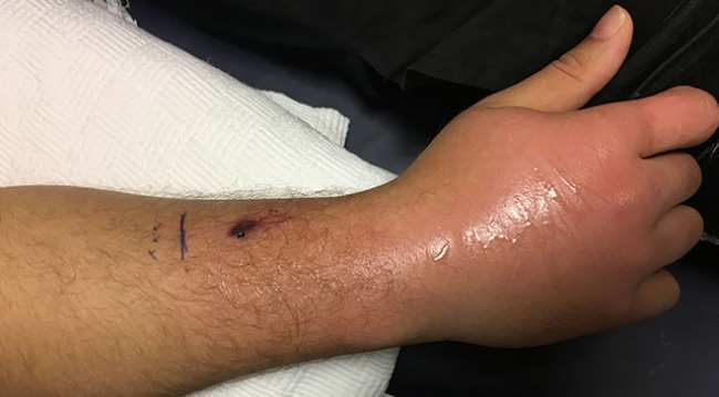 İllüzyonist Aref'ten ilk açıklama: Kısmi felç olabilirim