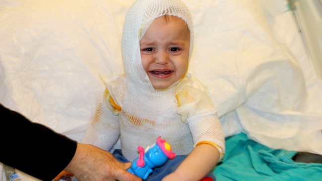 1 yaşındaki bebeğin üzerine kaynar süt döküldü