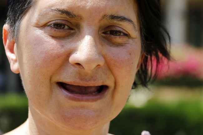 Beyaz diş isteği 32 dişine mal oldu