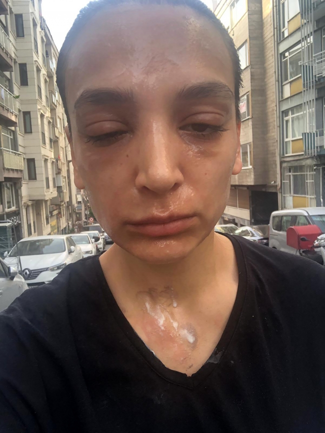 Lavabo açıcı bomba gibi patladı