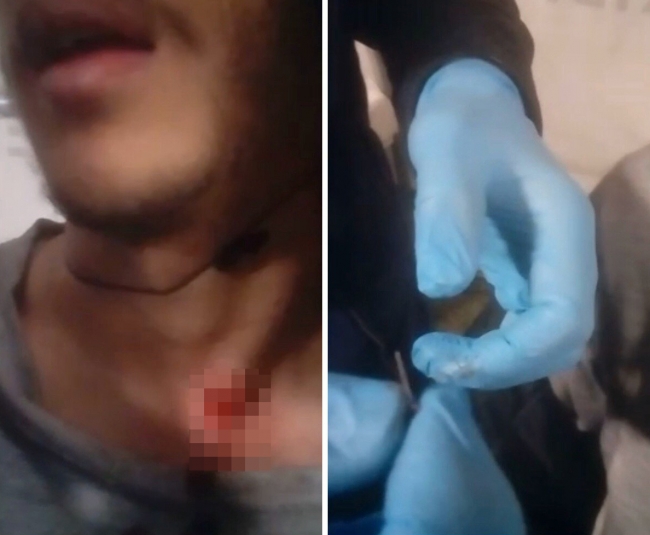 Yunanistan, plastik mermileri saplanması için tel ile güçlendiriyor