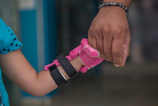 'Prenses el' küçük Evin'e umut oldu