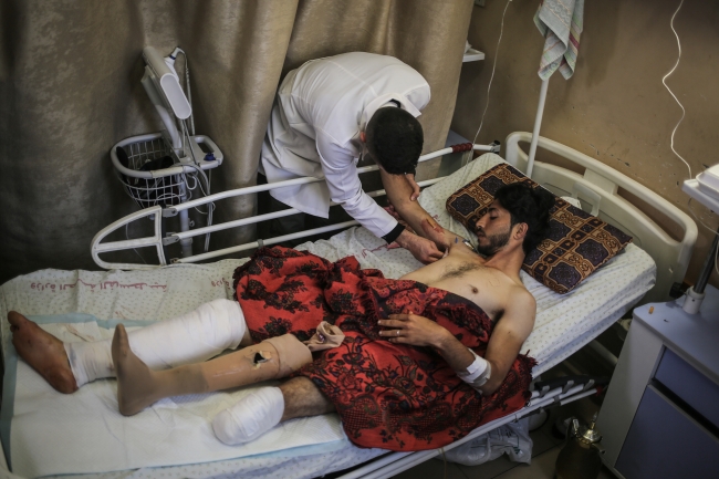 İsrail, Filistinli genci protez bacağından etti