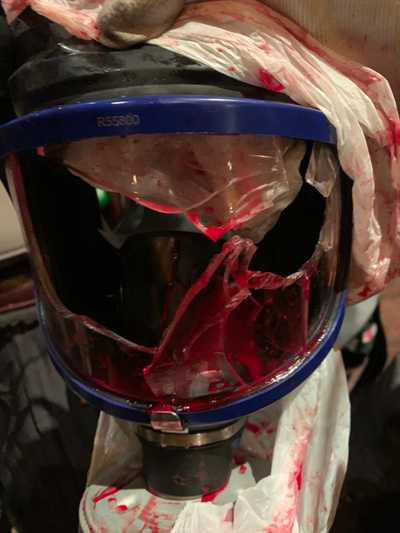 Paris'te gözünden yaralanan AA Foto Muhabiri Yalçın, yaşadıklarını anlattı