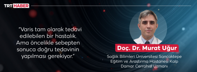 5 soruda varis tedavisi