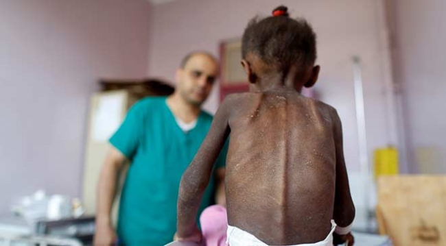 Çocukların gözünden dünya: Hastalık, açlık ve savaş