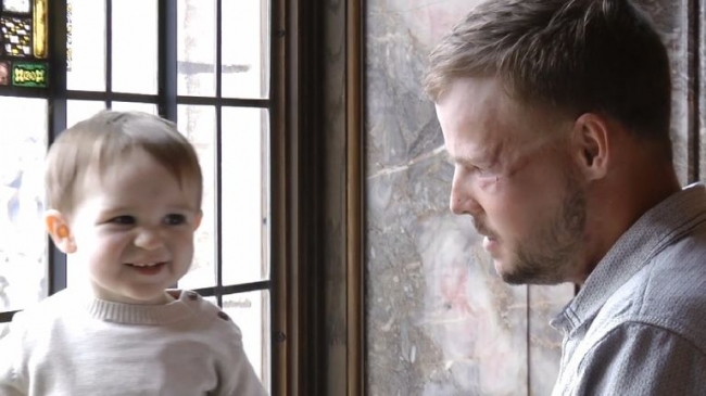 Kocasının yüzünü bağışlayan kadının duygusal anları