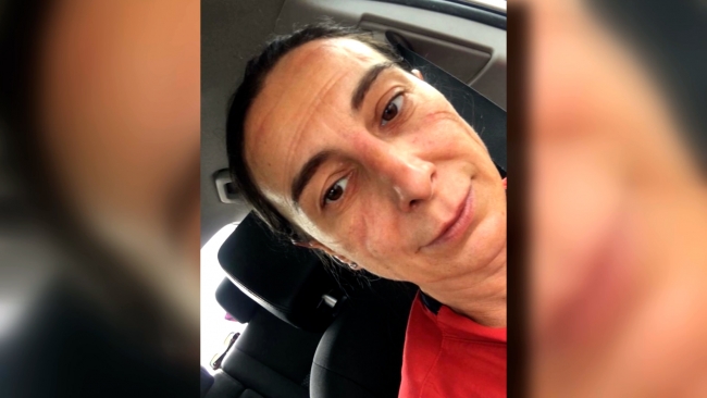 Maske izi onların yüzlerine, fotoğrafları ise Türkiye’nin yüreklerine kazındı