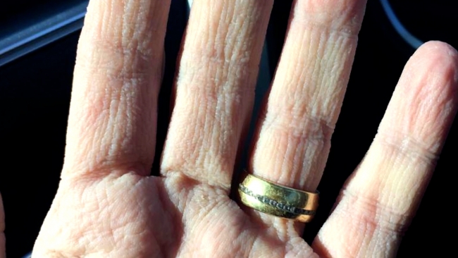 Maske izi onların yüzlerine, fotoğrafları ise Türkiye’nin yüreklerine kazındı