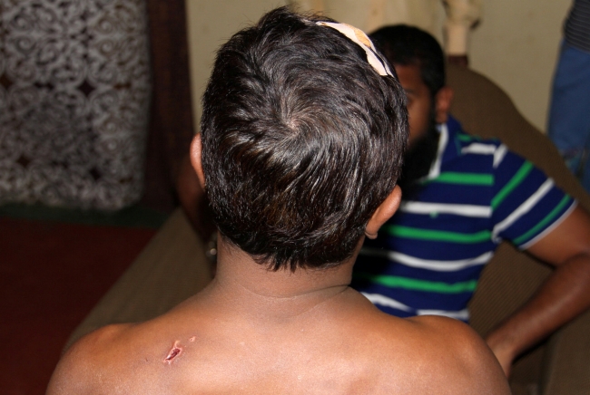 Sri Lanka'da 2018'deki olaylarda şiddete maruz kalan bir Müslüman. Fotoğraf: Reuters