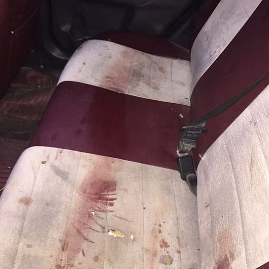 Darbecilerin vurduğu taksisiyle yaralıları hastaneye taşıdı