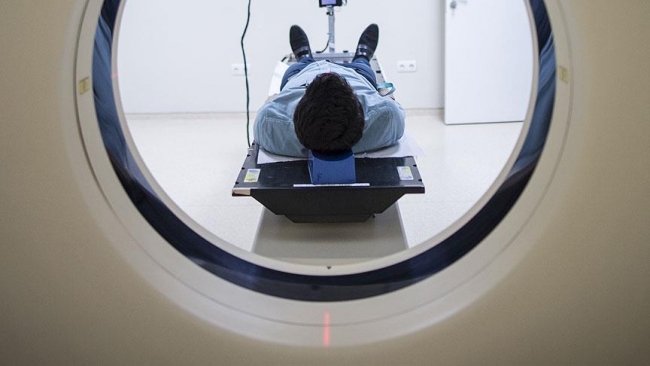 Her unutkanlık alzheimer değil