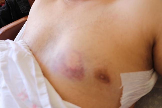 Vefa ekibi saldırısında yaralanan belediye personeli: Arkadan saldırdılar