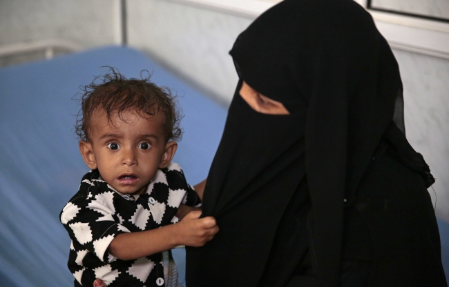 Yemenli babaların tek hayali çocuklarına yiyecek götürebilmek