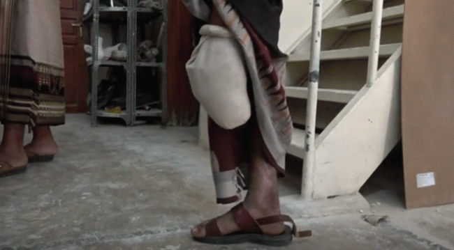 Yemen'e döşenen mayınlar can almaya devam ediyor