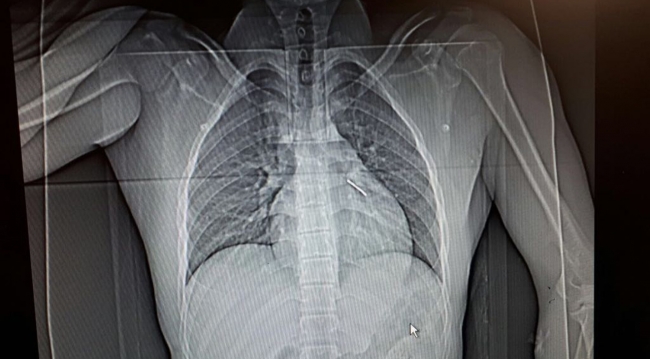 10 dakika ile hayata tutundu