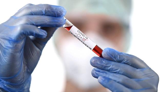 Avustralya Hazine Bakanı Frydenberg koronavirüse yakalandı