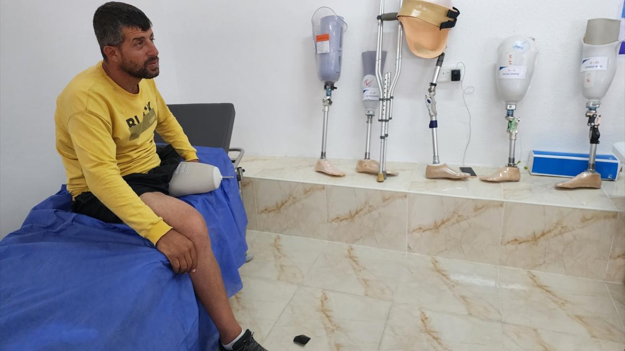 Gazze Protez Hastanesi saldırılarda uzuvlarını kaybedenler için umut ışığı oluyor