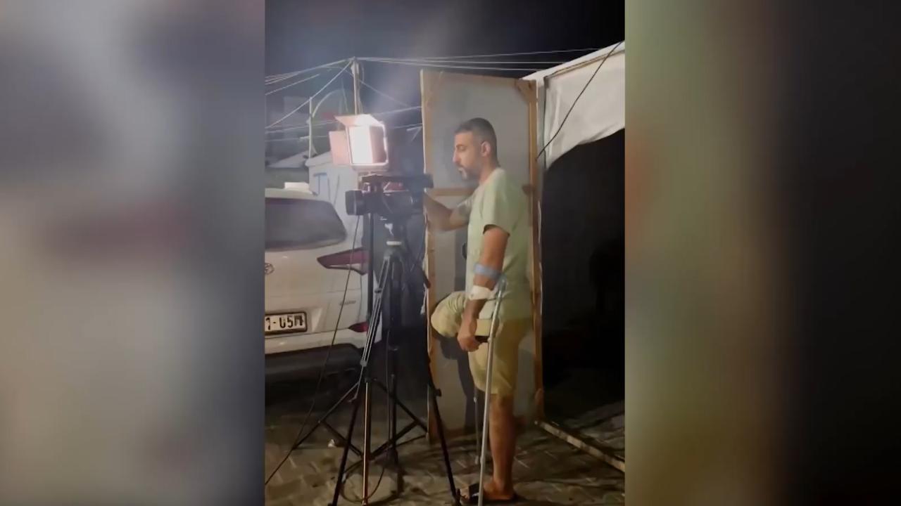 Bacağını kaybeden TRT Arabi kameramanı işinin başında